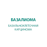 Базальноклеточная карцинома